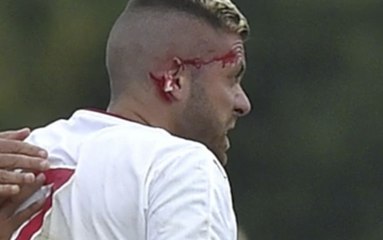 Jérémy Menez perd un bout d'oreille - Bordeaux vs. Lorient
