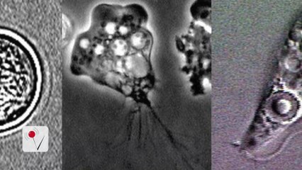 Brain-Eating Amoeba Confirmed In South Carolina