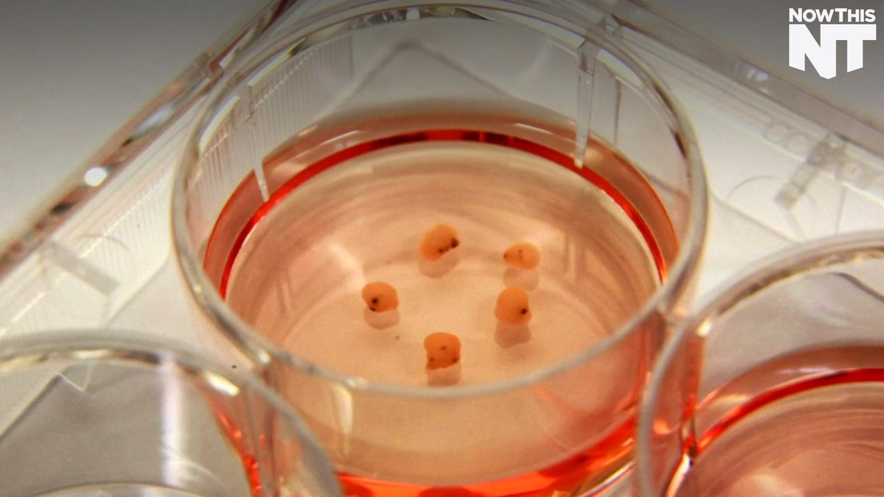 Scientists Grow Brain Tissue From Stem Cells