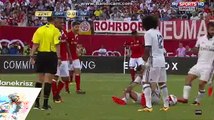 James Rodriguez Gets Injured - Bayern Munich vs Real Madrid - International Champions Cup - 03/08/2016
