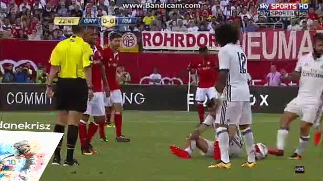 James Rodriguez Gets Injured - Bayern Munich vs Real Madrid - International Champions Cup - 03/08/2016