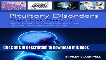 PDF  Pituitary Disorders: Diagnosis and Management  Free Books KOMP B