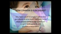 Gum Disease FAQs