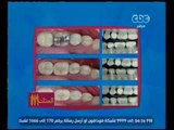 الستات مايعرفوش يكدبوا | الجديد في طب تجميل الأسنان مع استشاري طب الفم والأسنان