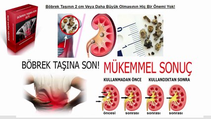 Böbrek taşı düşürenler