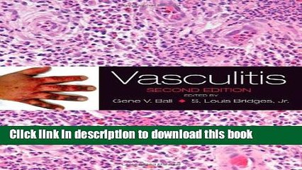 [PDF] Vasculitis Download Full Ebook
