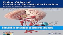 Books Color Atlas of Cerebral Revascularization: Anatomy, Techniques, Clinical Cases Full Online