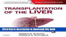 Books Transplantation of the Liver Full Online