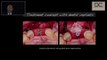 Soft Tissue Management in Implant Dentistry