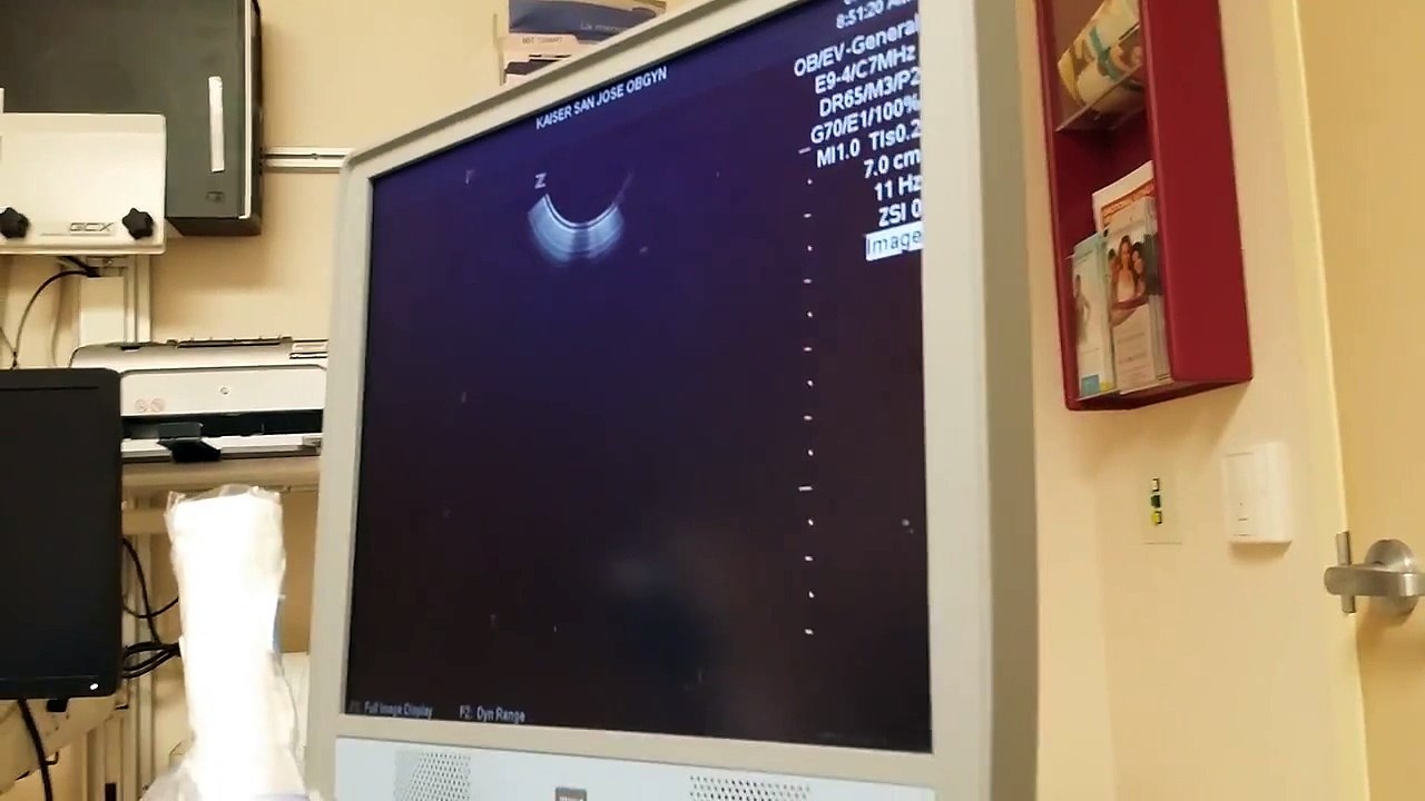 ultrasound 19 weeks 2 days pregnancy my sweet baby