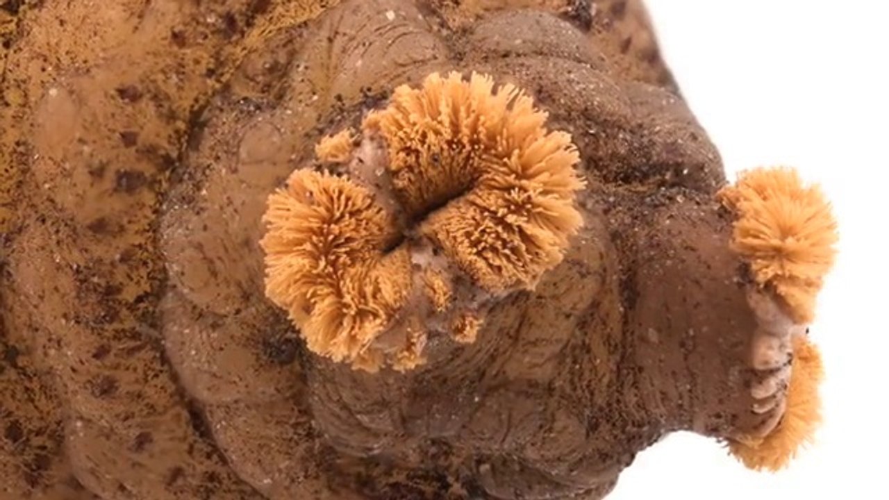 Une larve de mouche éclos dans un bras humain