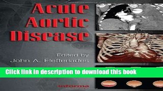 Books Acute Aortic Disease Free Online