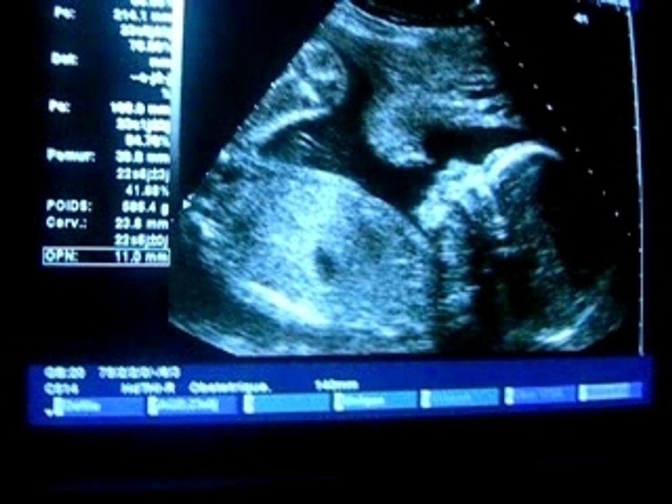 5 mois