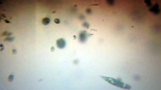 Phytoplankton Chaos: Allendale Microscopy 06/30/15