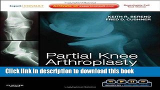 Books Partial Knee Arthroplasty: Techniques for Optimal Outcomes with DVD; Expert Consult - Online