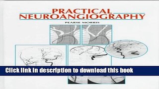 Download Practical Neuroangiography Book Online