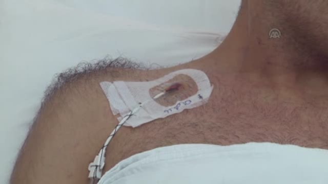 İç Savaştan Kaçtı Darbe Girişiminde Yaralandı