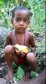 Nagada: Malnutrition in Children