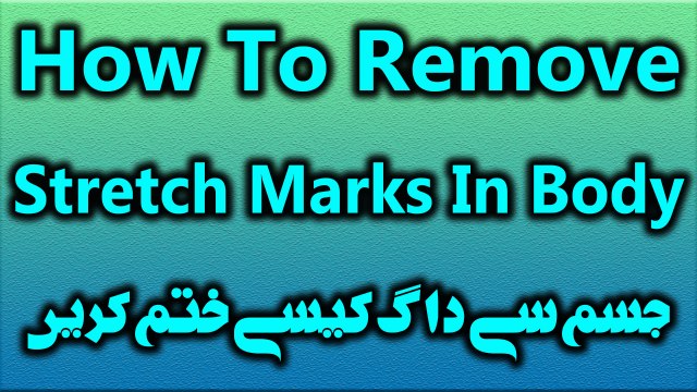 How To Remove Body Stretch Marks In Hindi | Jism Pe Stretch Marks Ko Khatam Kaise Karen