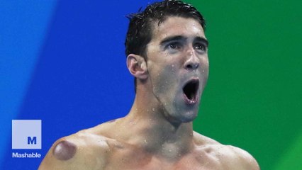 Why Michael Phelps has purple dots all over his body