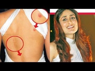 EXPOSED: SHAMELESS Kareeena Kapoor shows LOVE BITES!