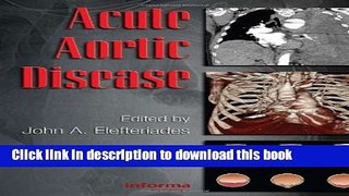 [Download] Acute Aortic Disease (Fundamental and Clinical Cardiology) Kindle Free