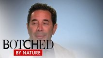 Botched by Nature | Botched By Nature Finds Extreme Cases Wednesdays on E! | E!