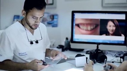 Smile make over at SameDay Dental Implants Clinic-Dubai