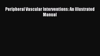 [PDF] Peripheral Vascular Interventions: An Illustrated Manual Read Full Ebook