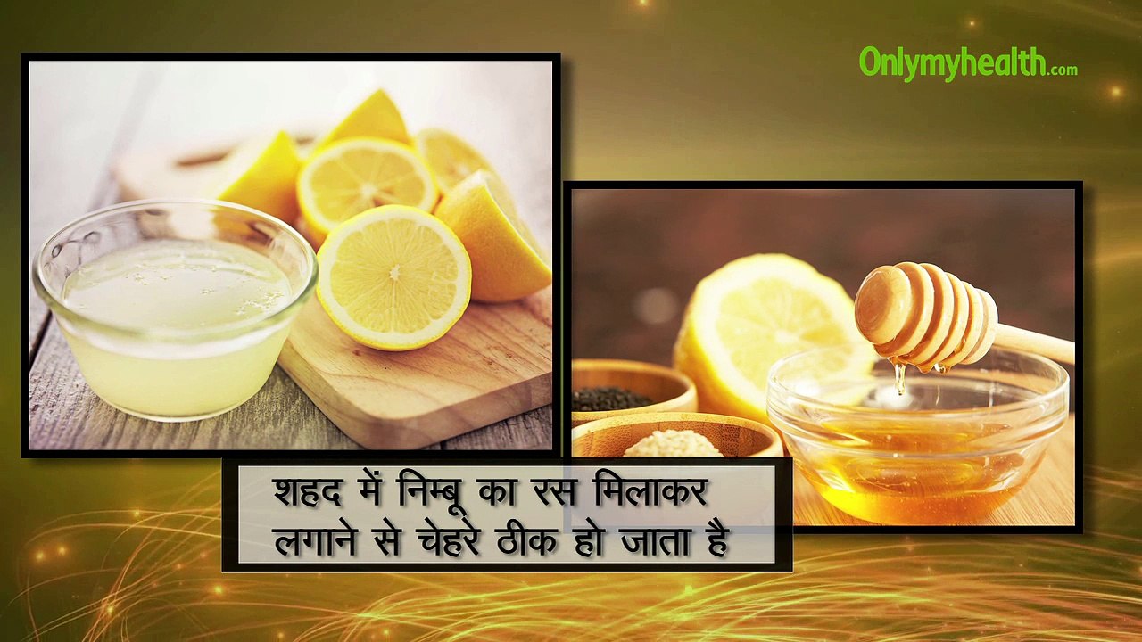इन घरेलू नुस्खे से दूर करें चेहरे के दाग-धब्बे...