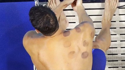 الحجامة تخطف الأضواء بأولمبياد ريو