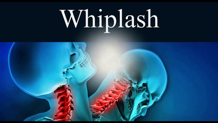 Whiplash Explained Dr. Gregory King Cumming Ga