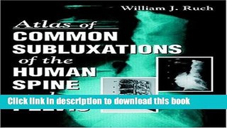 [Download] Atlas of Common Subluxations of the Human Spine and Pelvis Kindle Collection