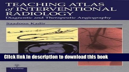 [Download] Teaching Atlas of Interventional Radiology: Diagnostic and Therapeutic Angiography