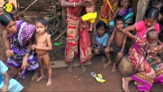 Children die of malnutrition