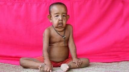 The Boy Who Looks Like An Old Man: BORN DIFFERENT