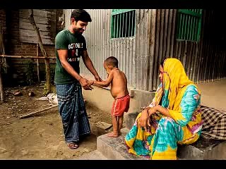 Agé de 4 ans, cet enfant est surnommé le Benjamin Button du Bangladesh