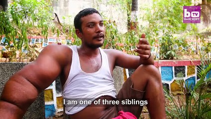 A 25 ans il vit un enfer avec un bras de 20 kg