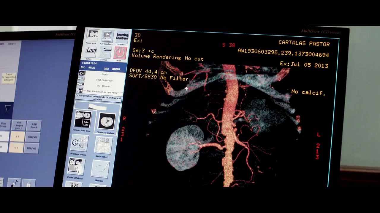 Ablations - VF