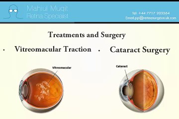 Mahi Muqit Retina Specialist