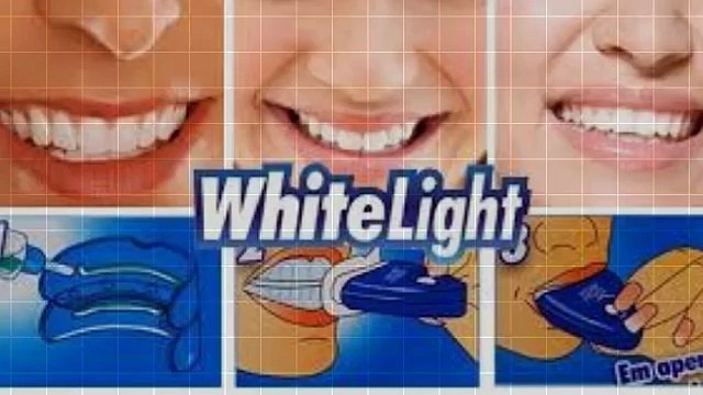 White Light Teeth Whitener