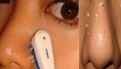 Amazing Toothbrush Skincare Treatment Must Try it.