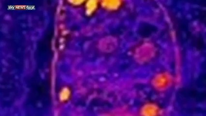 داء القطط.. مرض يدفع النساء للانتحار