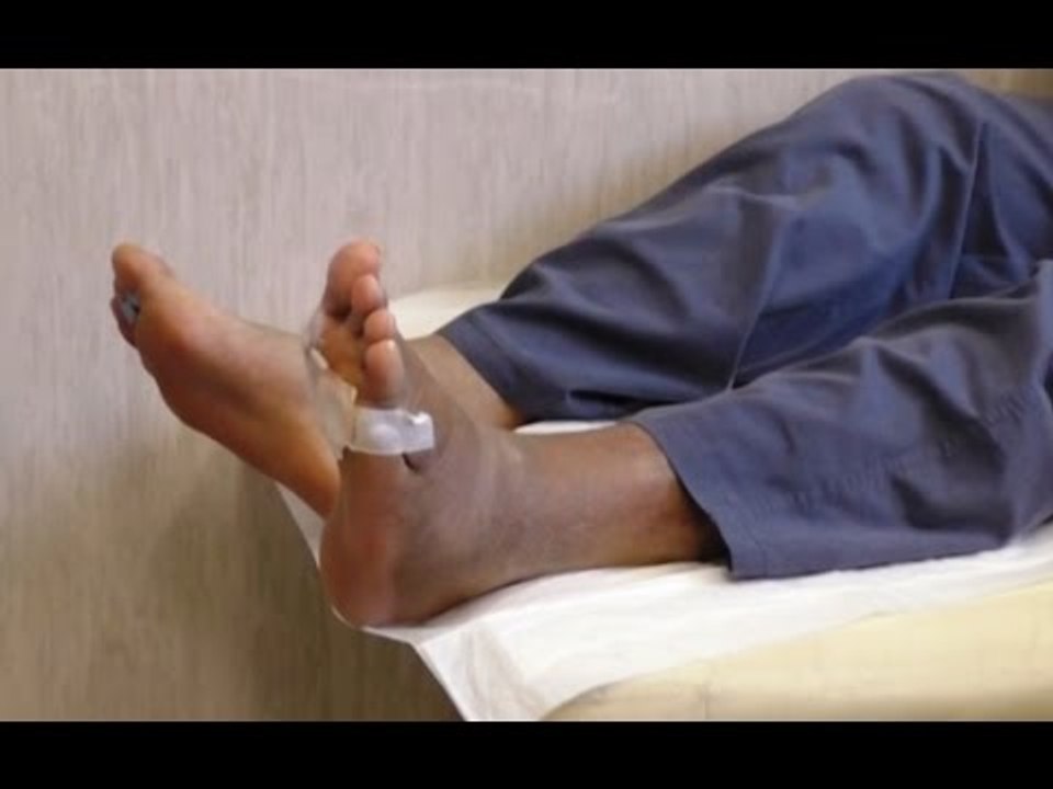 Piede diabetico, la Federico II in campo per la prevenzione (11.08.16)