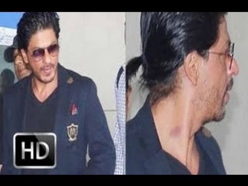 Spotted: SRK with love bite on his neck