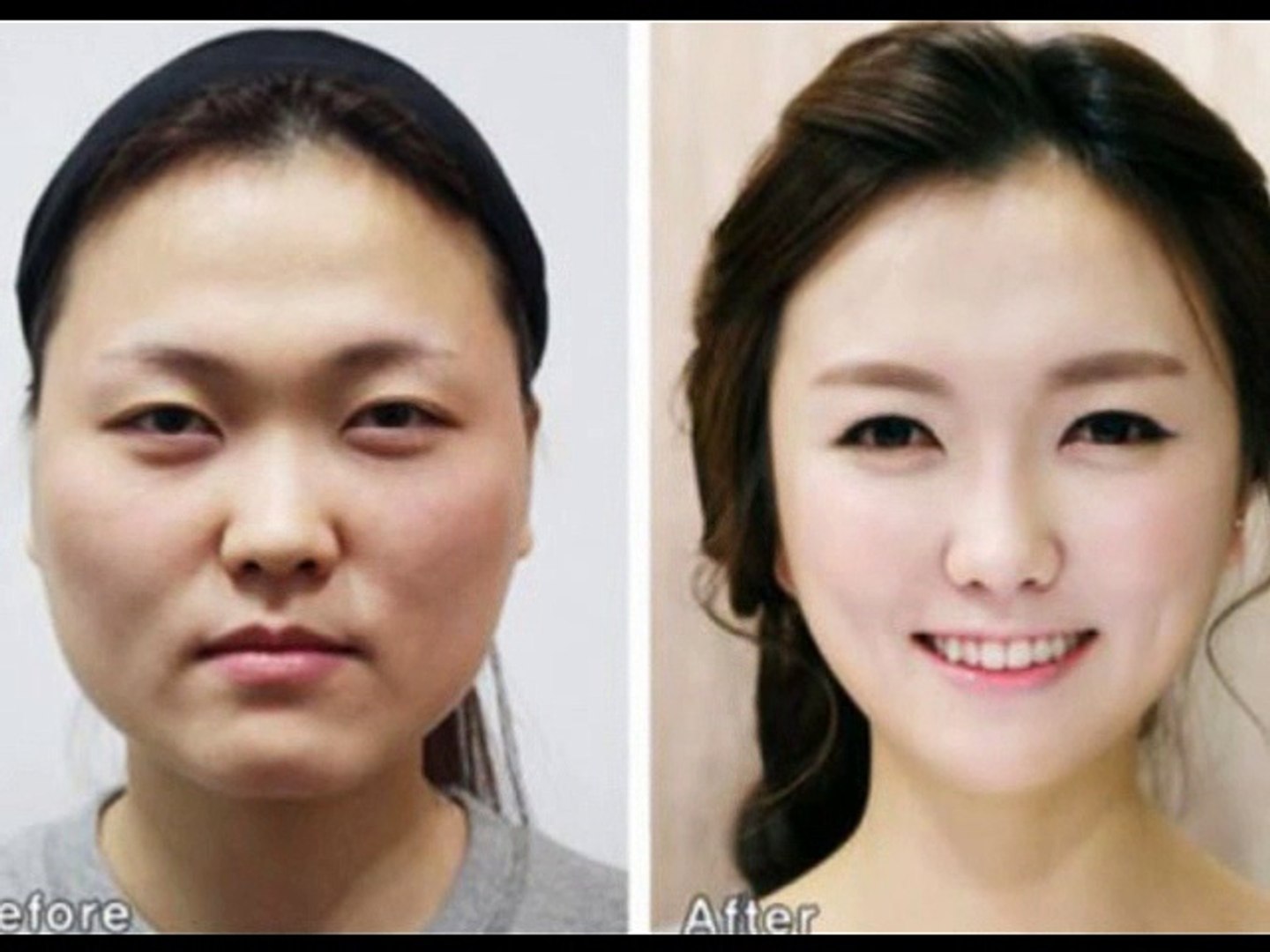 korean actress before and after plastic surgery - video Dailymotion