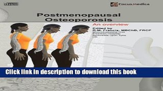[Popular] Postmenopausal Osteoporosis: An Overview Kindle Online