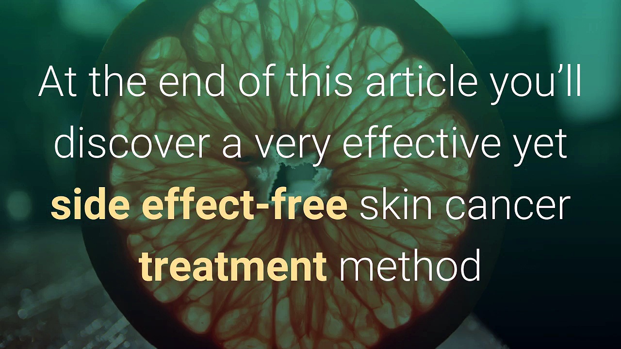 Skin Cancer Treatment-Skin Cancer Treatment Revolutionized