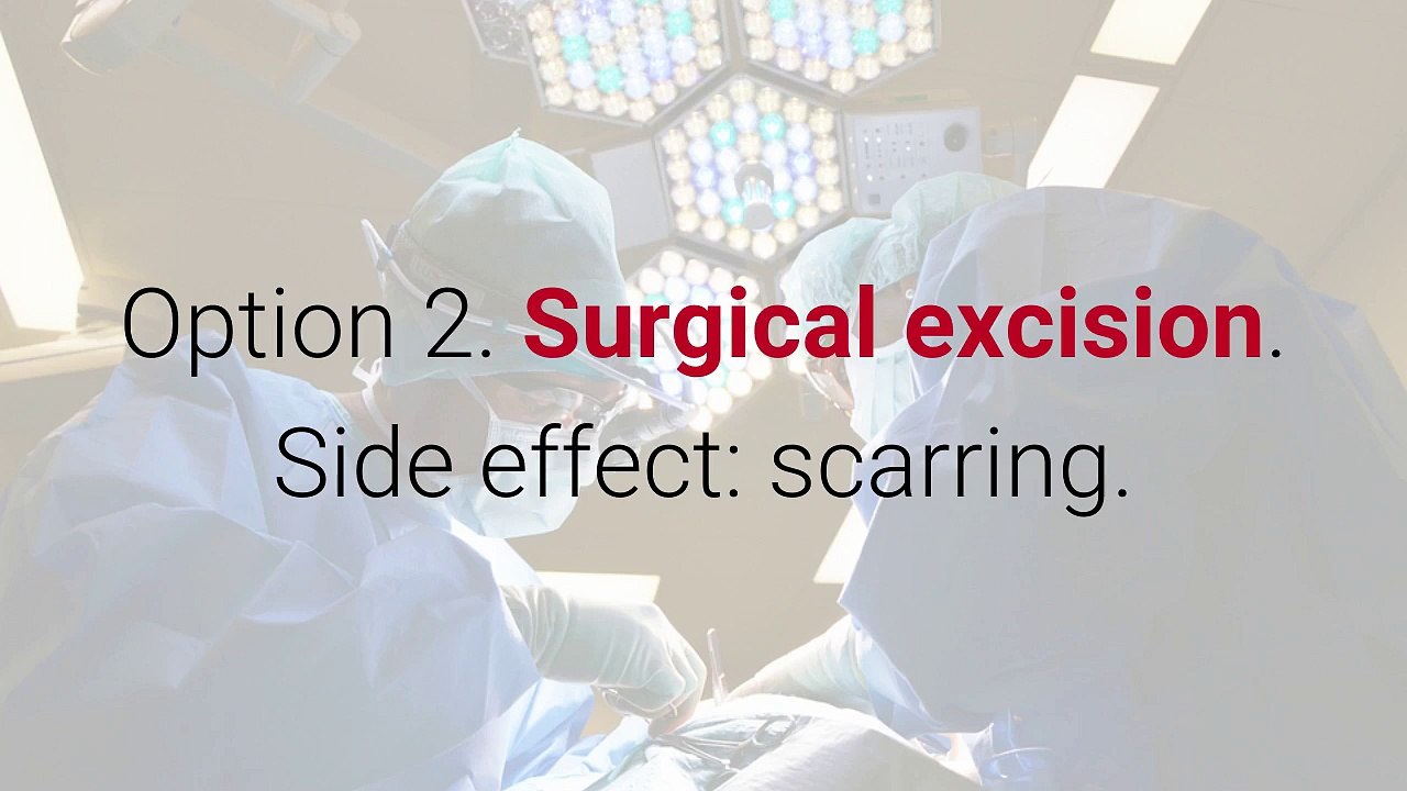 Better Than Basal Cell Carcinoma Removal?