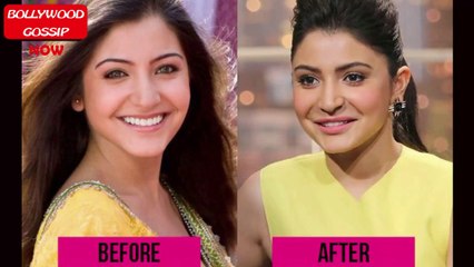 Top 10 Bollywood actress After And Before Plastic Surgary